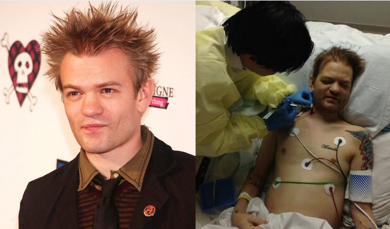 Hard boozing' put Sum 41 frontman Deryck Whibley in hospital